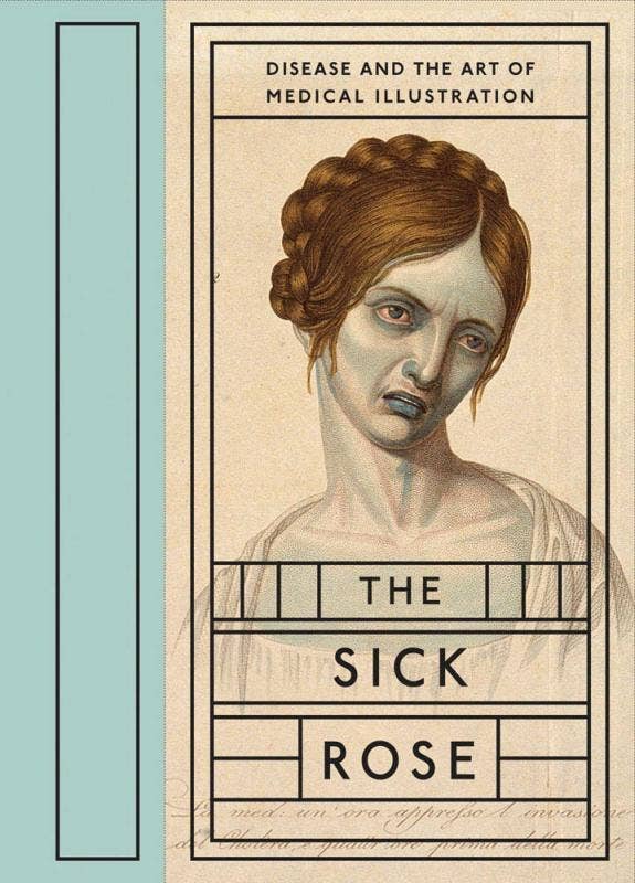Microcosm Publishing & Distribution - Sick Rose: Disease and the Art of Medical Illustration - The Oddity Den